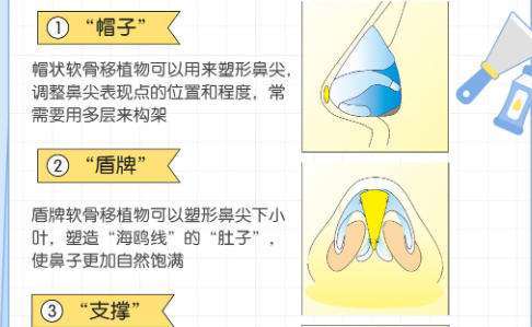 隆鼻9.jpg