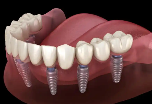 55.png