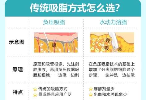 吸脂