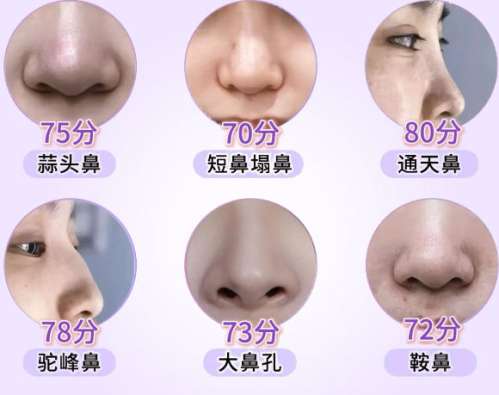 隆鼻