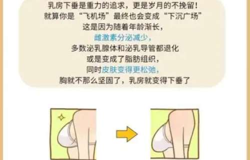 隆胸