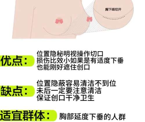 隆乳