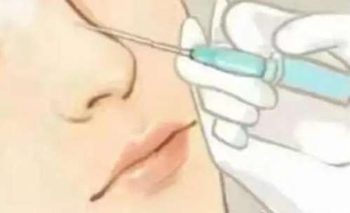 隆鼻