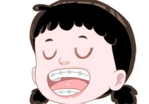 牙齿矫正2.jpg