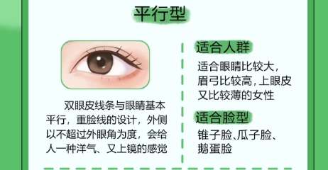 双眼皮 双眼皮
