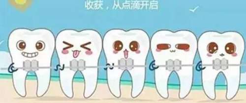 牙齿矫正 牙齿矫正
