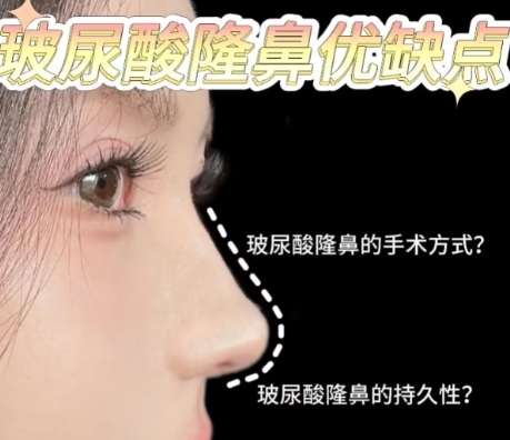 隆鼻