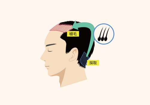 头发 (12).jpg