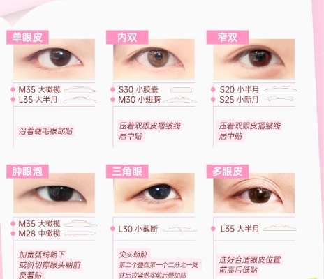 双眼皮 双眼皮