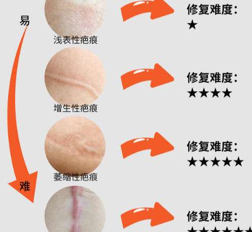祛疤2.jpg 祛疤2.jpg