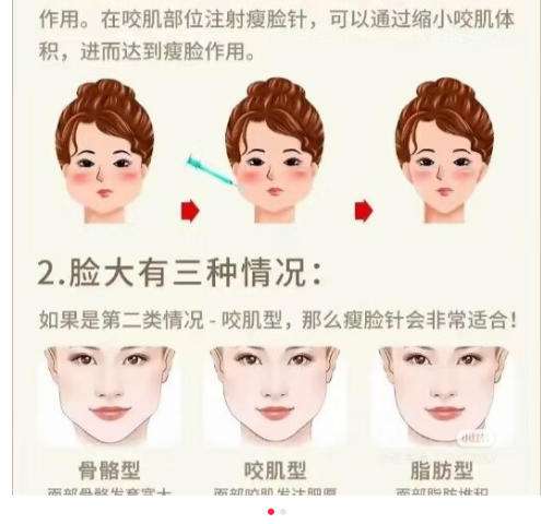 瘦脸.jpg