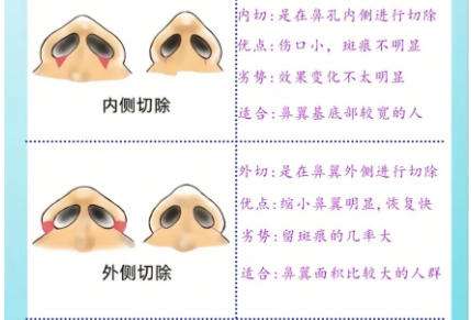 隆鼻7.jpg