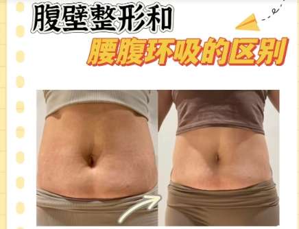 吸脂