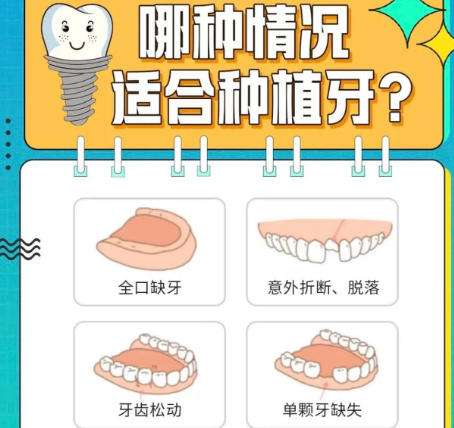 牙齿种植