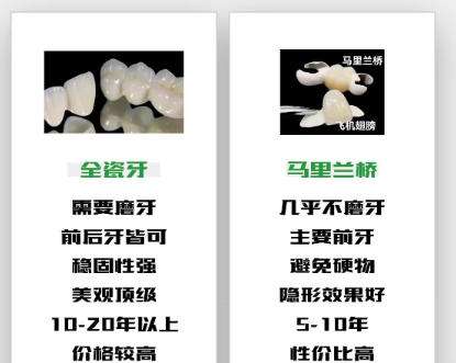 全瓷牙 全瓷牙