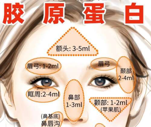 注射胶原蛋白美容 注射胶原蛋白美容