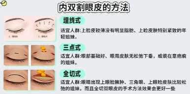 双眼皮