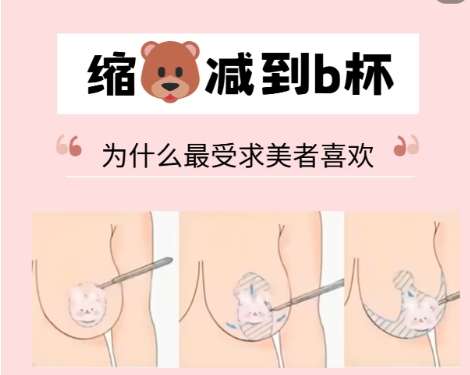 缩胸