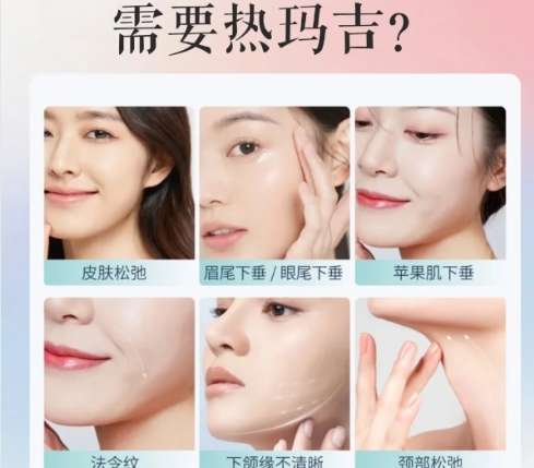 热玛吉 热玛吉