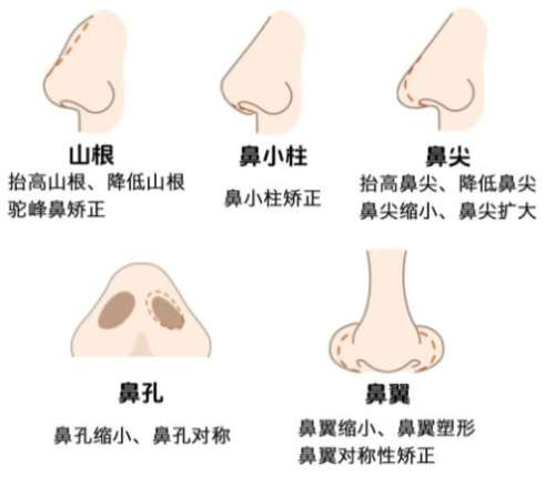 隆鼻4.jpg 隆鼻4.jpg