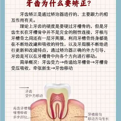 牙齿矫正