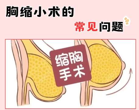 北京八大处辛敏强乳房缩小手术价格表更新！低至1万4左右！