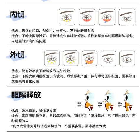 大连医科大学附属第一医院胡刚去眼袋怎么样 ？精选医生资料和去眼袋案例详情