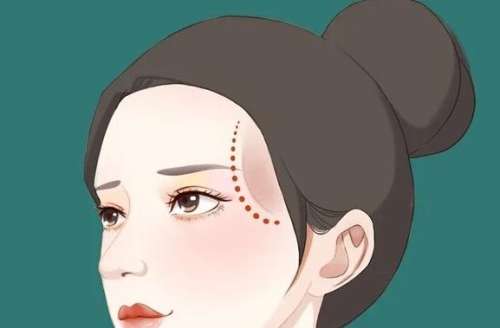武汉填充太阳凹脸颊大概多少钱?大致在18,718~49,774元左右!
