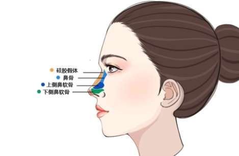 大同隆鼻硅胶多少钱？2.4w起？2026年7月当地收费表数据更新！