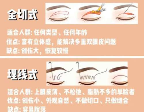 周传德医生口碑怎么样？多少钱？费用低至2w7左右