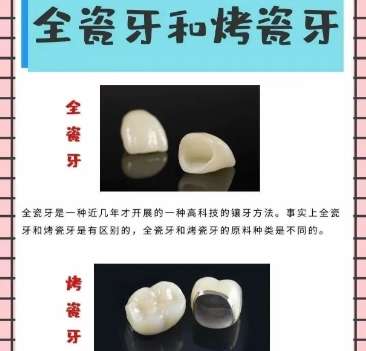 长春全瓷牙贴面多少钱？2025收费细节公布！