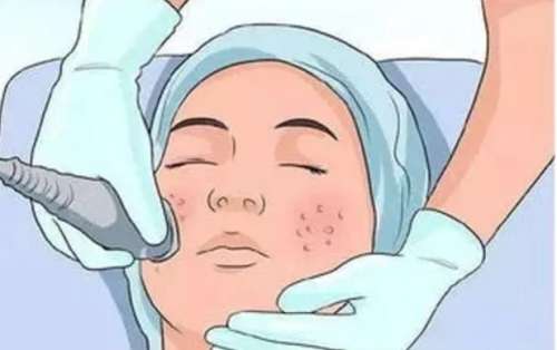 脸长斑是什么原因？原因分析及去除方法