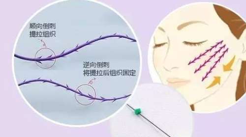 北京于晓春线雕价目表2026更新，轮廓固定价格1.5万元-2.9万元不等