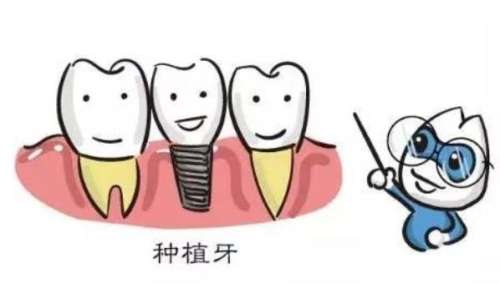 益阳种一颗牙大概要多少钱？影响因素/种植牙优势