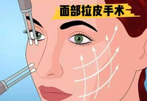 保定拉皮要多少钱？24,300元左右起！详细费用参考