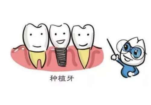 上海九医院牙齿种植价格多少?6000元起,价格明细+技术优势+口碑医生