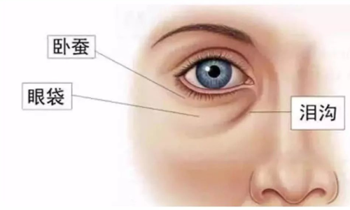 上海十院眼袋手术费用多少？收费标准与医生推荐，附真实案例