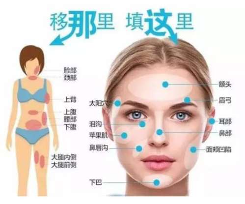 上海脂肪填充脸部好的医生排名2026上新-魏皎、汪汇等技术价格全解析
