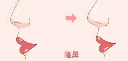 北京做肋骨鼻部综合多少钱？在24313元至76531元之间