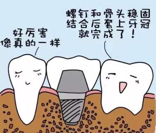 大连种植牙一颗多少钱——全新费用明细，各品牌种植体报价