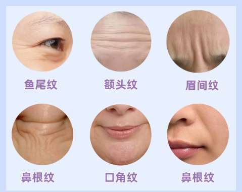 北京协和医院刘志飞做面部年轻化怎样？经典案例展示！