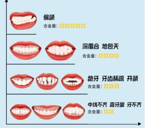 长春地包天手术要多少钱？推荐几家口碑好又实惠的机构！