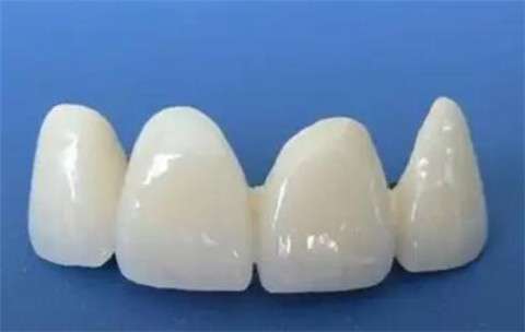 海口烤瓷牙多少钱一颗？