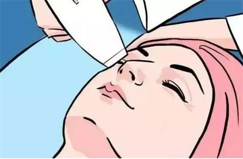 热玛吉手术价格贵吗？技术优势在线观看