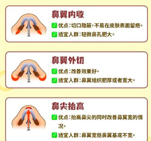 南宁鼻翼缩小大概多少钱？公立/私立医美鼻修复报价对比分析