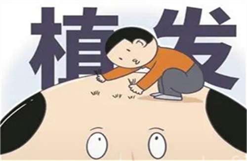 秃顶植发价格怎么算？毛发价格计算公式给到您