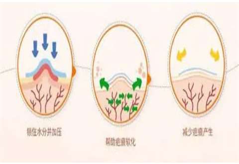 疤痕修复手术一般多少钱正规医院，治疗次数怎么样？进入查看科普知识