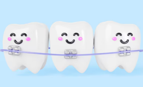 厦门牙齿矫正手术多少钱？手术相关收费和后续支出这篇讲透