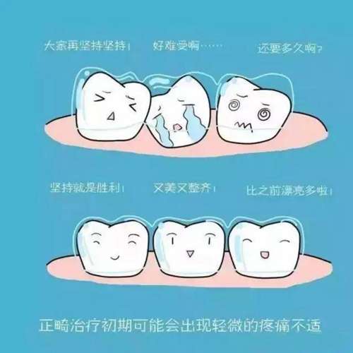 补牙多少钱一颗牙？200-1000元左右价格不固定！