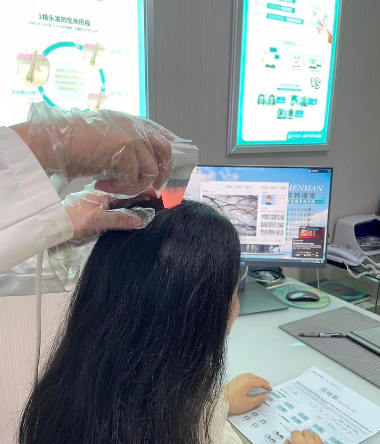 成都双禾植发有哪些特色项目？相关技术全面解析，真人案例分享